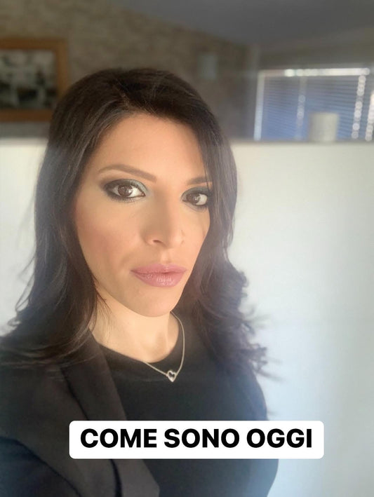 ALOPECIA NON TI TEMO!!