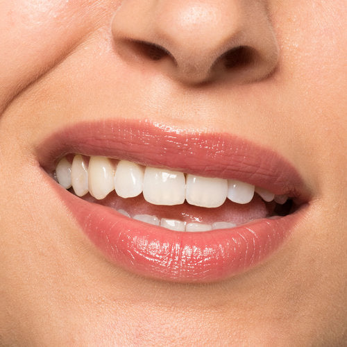 LIP REPAIRE